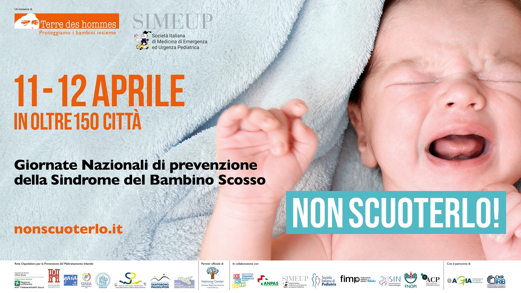 Sindrome del bambino scosso: fatale in un caso su quattro